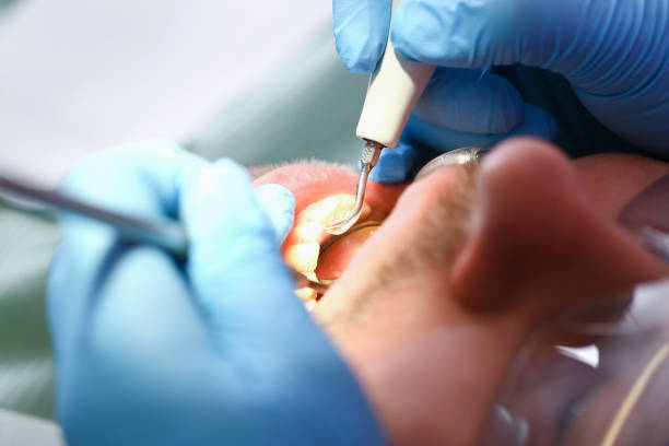 Best Emergency Gum Treatment in Greenwood, MS